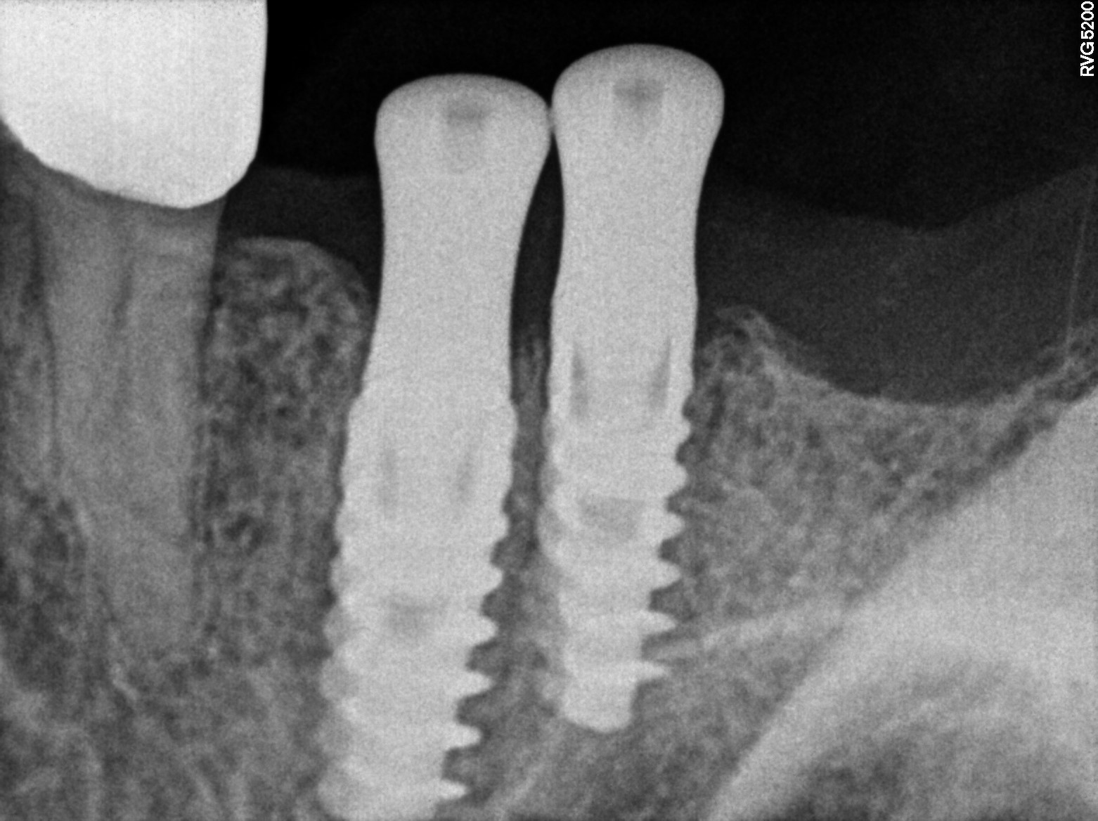 Dental X-ray
